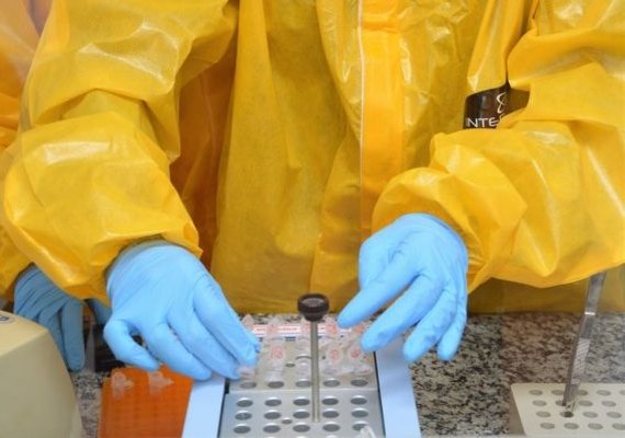 Estado vai ampliar exame de RT-PCR para alagoanos com síndrome gripal