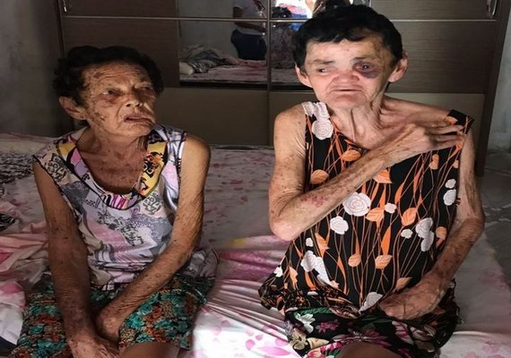 Mulher mata avó espancada e a mãe também é alvo das agressões