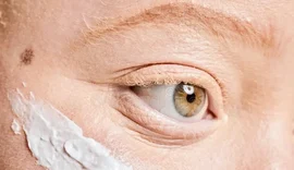 Maceió garante protetor solar gratuito para pessoas com albinismo