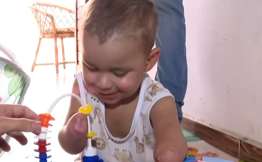 Milagre e superação: a luta do pequeno Noah após amputações