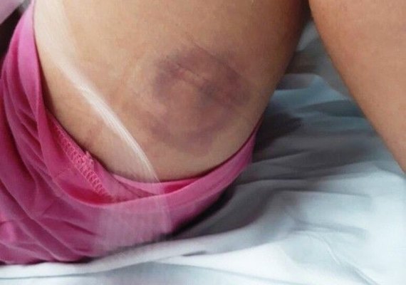 'Foi um milagre', diz mãe que viu filha ser baleada após erro de GPS