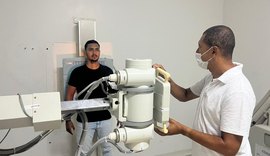 Hospital implanta equipamento de radiologia digital e realiza 1.900 exames em três meses