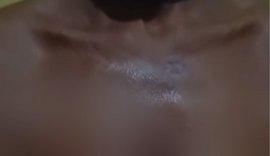 Mulher é queimada com óleo quente pelo companheiro em Mata Grande