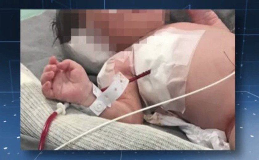 Indícios apontam que tiro que atingiu bebê na barriga da mãe saiu de traficantes