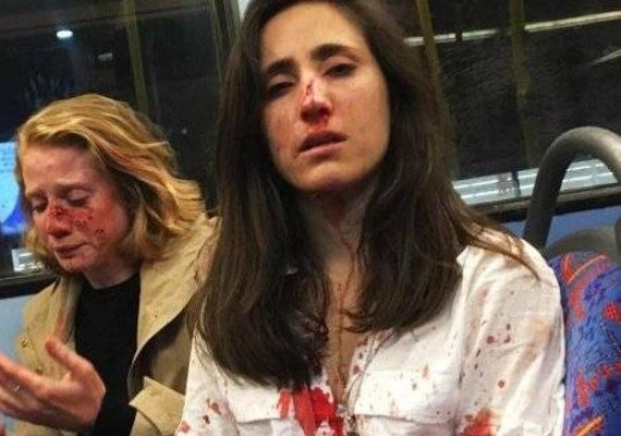 Casal de lésbicas é atacado por grupo de homens em ônibus