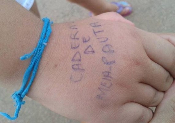 Professora manda recado rabiscado em mão de criança e revolta pais