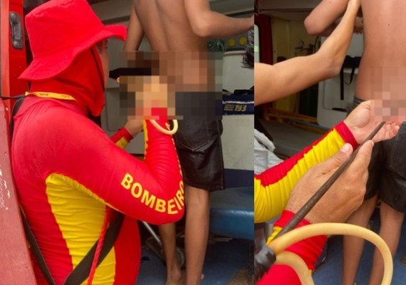 Adolescente é atingido por arpão durante pesca subaquática na Praia do Francês