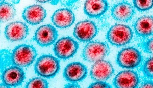HIV: dois novos casos de cura são anunciados; total chega a 13