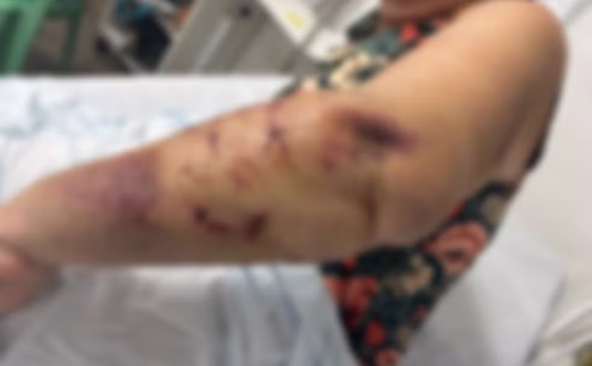 Turista de 70 anos é atacada por três cães e sofre ferimentos graves em Paripueira