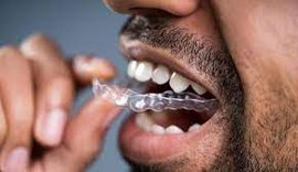 Bruxismo: Hábito de ranger os dentes pode causar vários prejuízos, mas há tratamento