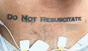 Homem com tatuagem 'não ressuscite' chega inconsciente a hospital e médicos ficam em dúvida