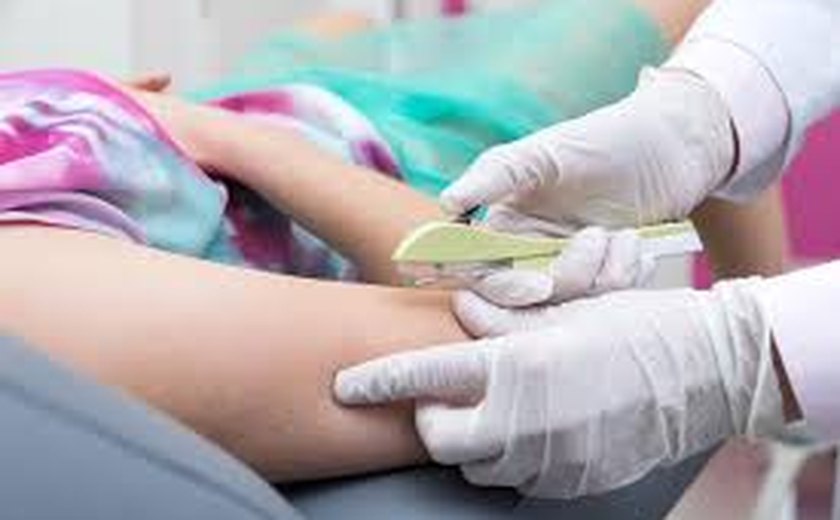 Ministério da Saúde vai qualificar 230 profissionais em Alagoas para ampliar a oferta de implante contraceptivo