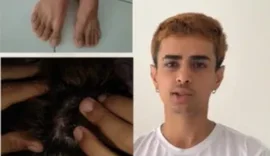 Entregador denuncia agressão após ser confundido com assaltante em Maceió