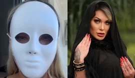 Influenciadora Andressa Urach mostra novo rosto após 50ª plástica: 'Voltar a 23 anos'