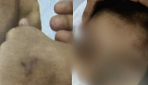 Inquérito policial que investiga caso de criança de 5 anos espancada pelo pai fica pronto em 10 dias