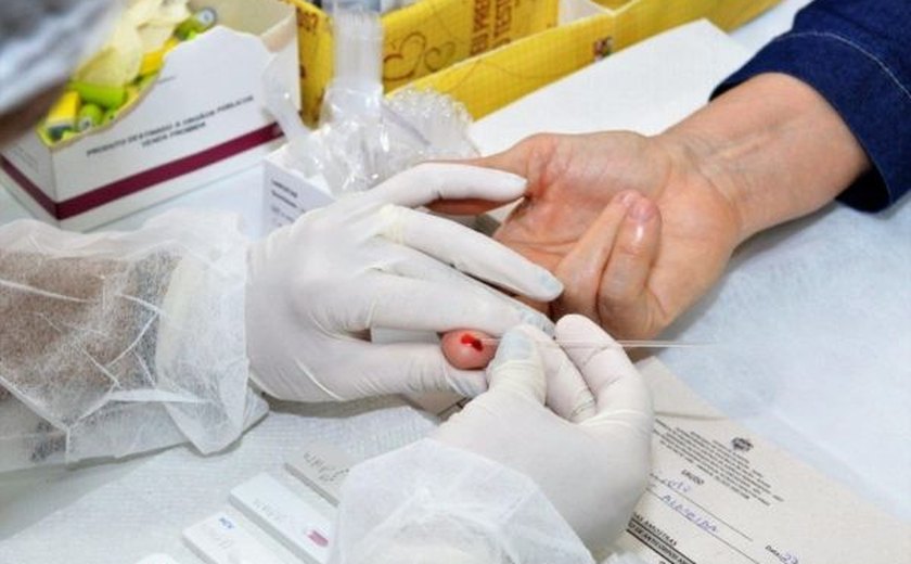 Em 32 anos, Estado de Alagoas registra mais de 6.800 casos diagnosticados de Aids