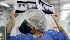 Lei institui campanha para conscientização sobre câncer de pulmão