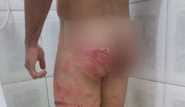 Justiça aceita denúncia contra militares suspeitos de torturar soldado