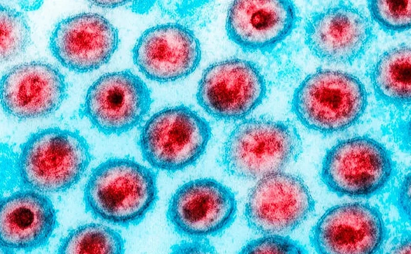 HIV: dois novos casos de cura são anunciados; total chega a 13