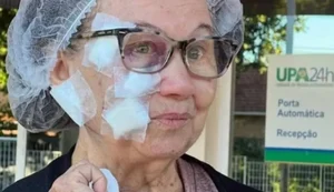 Mulher de 79 anos leva 50 pontos no rosto após ataque de pit-bull