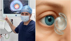 Professor da Uncisal lidera criação de lente para catarata aprovada pela Anvisa