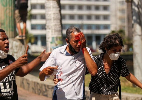 Dois homens atingidos pela PM com balas de borracha nos olhos perdem parte da visão