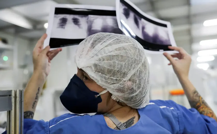Câncer de pulmão: 15% dos casos acontecem em não fumantes