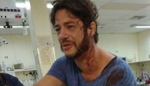 Ator de 'Sandy &amp; Jr' é agredido na cabeça e vai sangrando a hospital