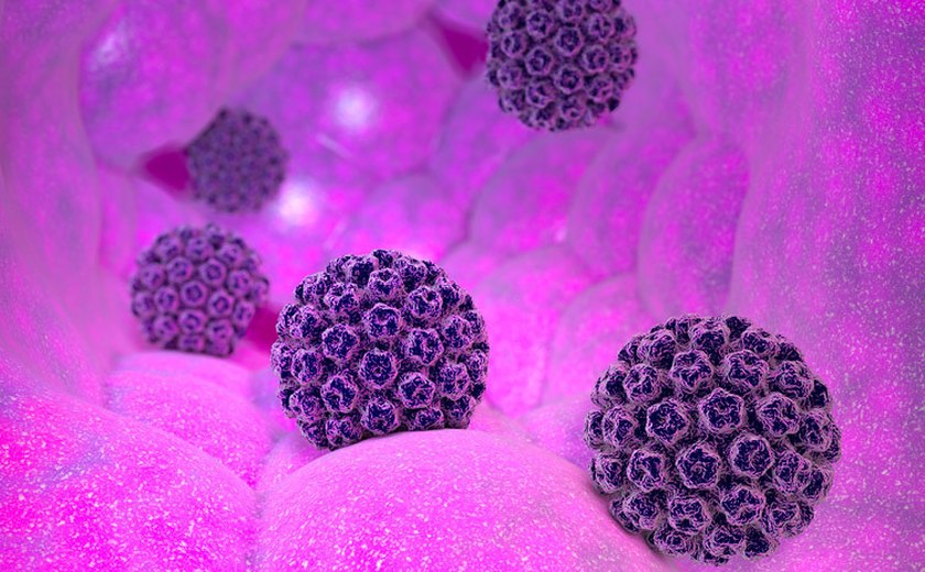 HPV afeta mais de 10 milhões de brasileiros e pode causar mais de cinco tipos de câncer