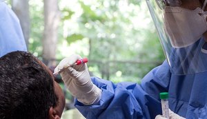 AL: nº de pessoas com sintomas combinados associados à Covid-19 cai pela metade em julho