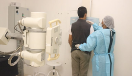 Hospital Ib Gatto realiza 2.744 exames de radiologia no terceiro trimestre deste ano