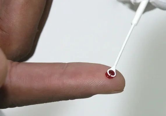 Fiji declara emergência nacional por HIV com 1 caso a cada 60 pessoas