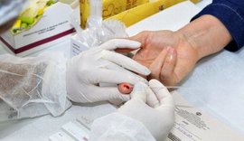 Em 32 anos, Estado de Alagoas registra mais de 6.800 casos diagnosticados de Aids