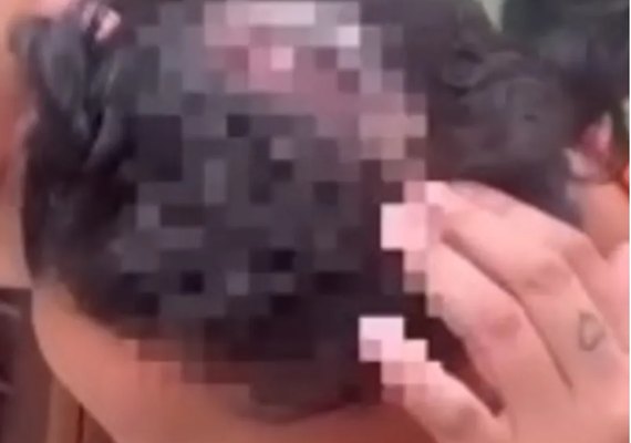 Homem ataca ex com golpes de foice na cabeça em Junqueiro