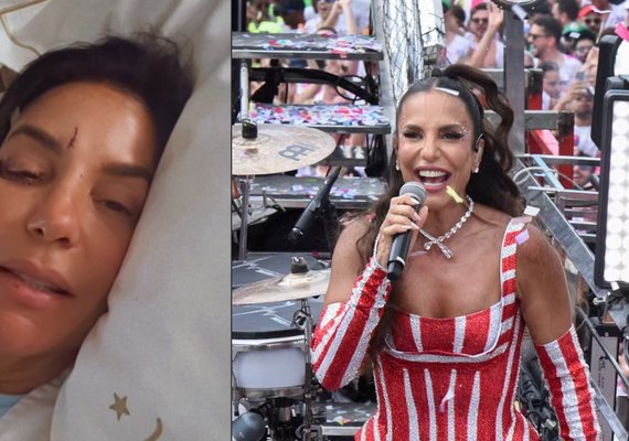 O que houve com Ivete Sangalo? Cantora surge machucada e explica motivo; veja vídeo
