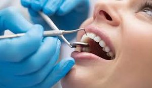 Contratação de planos odontológicos no país cresce mais de 35% desde 2020