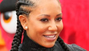 Mel B, ex-Spice Girl é internada com duas costelas quebradas e sem a mão