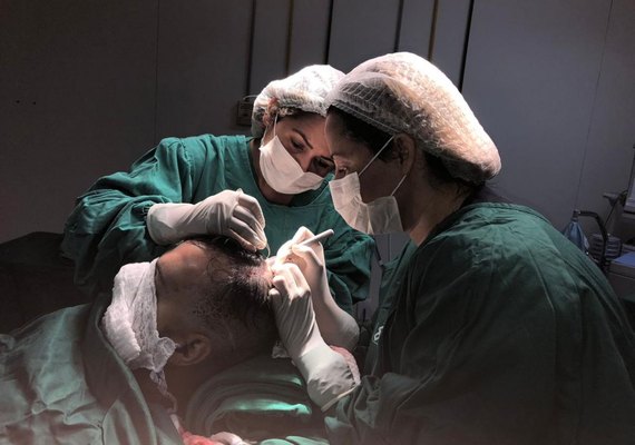  Transplante capilar ganha força em AL com sistema desenvolvido por Hospital Veredas