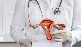 Alagoas tem o terceiro maior aumento de internações por endometriose no Brasil