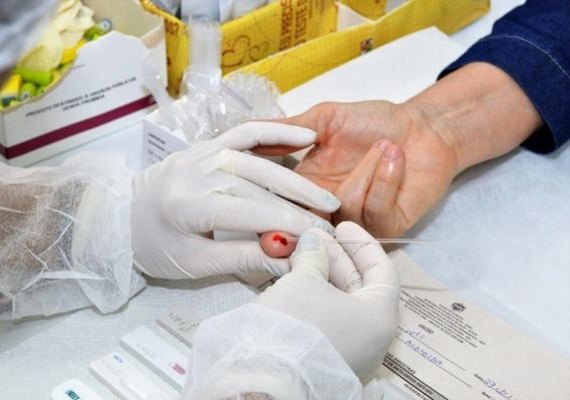 Em 32 anos, Estado de Alagoas registra mais de 6.800 casos diagnosticados de Aids