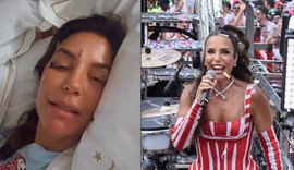 O que houve com Ivete Sangalo? Cantora surge machucada e explica motivo; veja vídeo