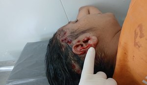 Mulher agredida durante diversão com conhecidos em Paulo Jacinto deve receber alta nesta semana