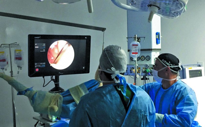 Santa Casa de Maceió inova com moderna tecnologia em videocirurgia ortopédica
