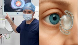 Professor da Uncisal lidera criação de lente para catarata aprovada pela Anvisa