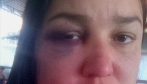 Eleitora denuncia ter sido agredida por defensores de Bolsonaro