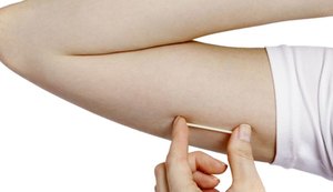 Adolescentes passam a ter acesso gratuito ao implante contraceptivo