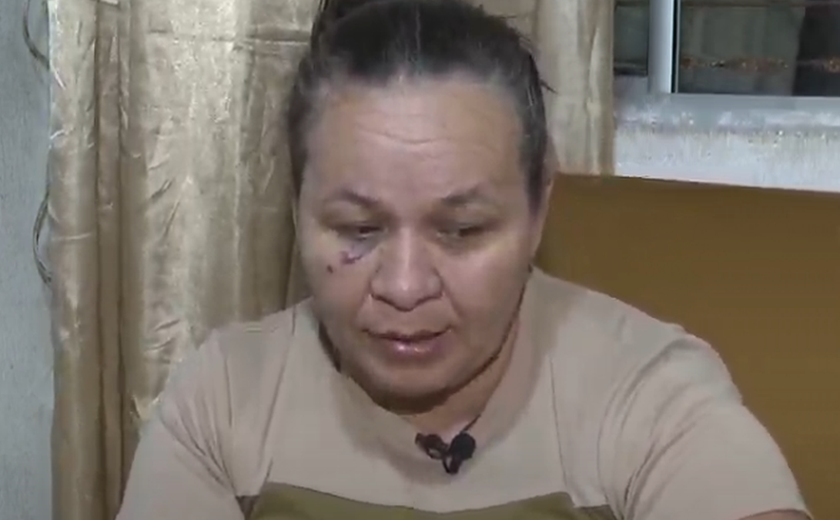 Cozinheira agredida com neto no colo por ex, policial militar, clama por Justiça