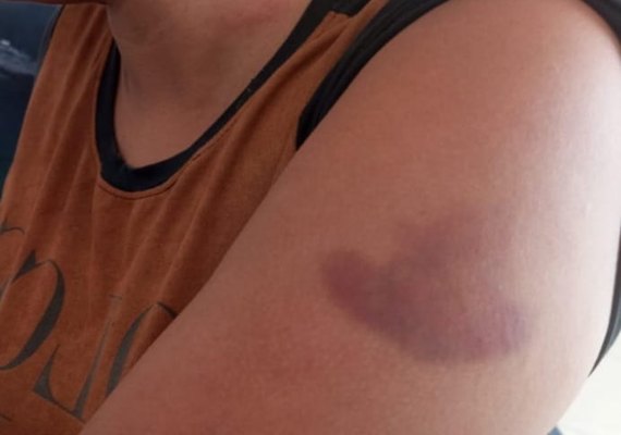Homem é preso após agredir companheira com socos na cabeça e pelo corpo