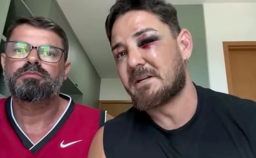 Turista agredido em Porto de Galinhas diz que violência foi maior por ser casal gay