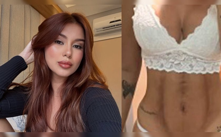 Influencer acusa clínica estética de 'deformar' seu corpo